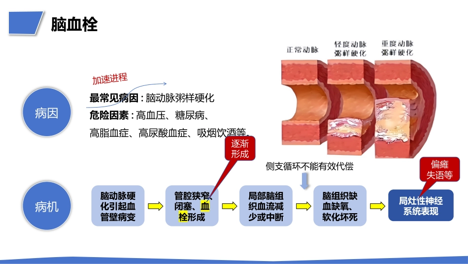 一例肺结节术后突发急性脑梗死疑难病例讨论_第14页