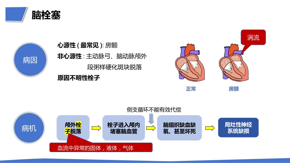 一例肺结节术后突发急性脑梗死疑难病例讨论_第15页