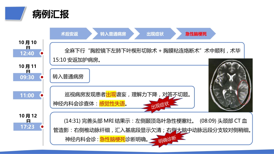 一例肺结节术后突发急性脑梗死疑难病例讨论_第5页
