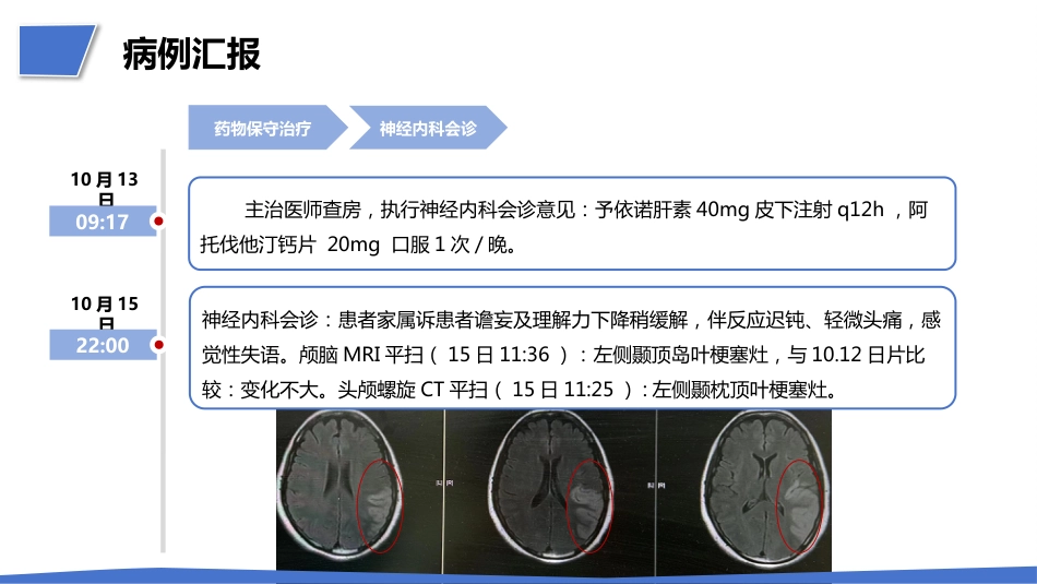 一例肺结节术后突发急性脑梗死疑难病例讨论_第6页