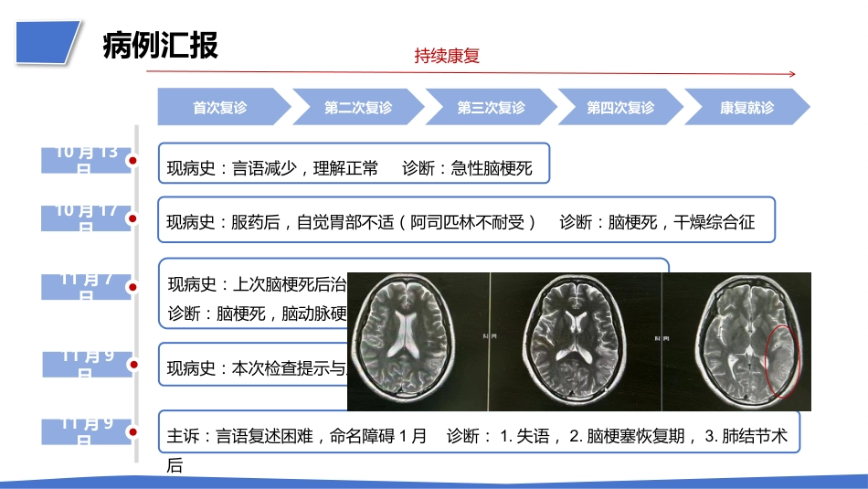 一例肺结节术后突发急性脑梗死疑难病例讨论_第8页