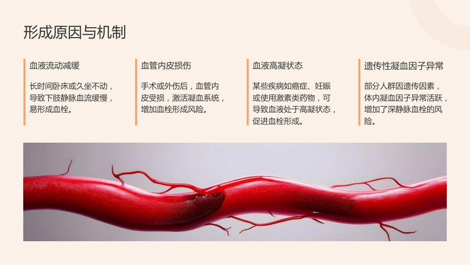 骨科深静脉血栓的预防及护理-2_第5页