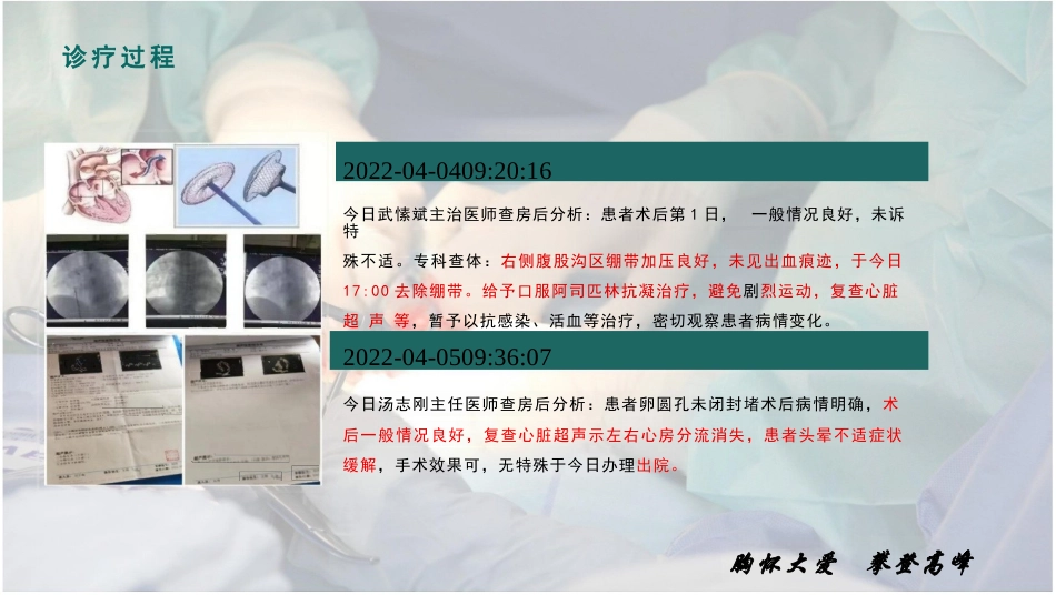 一例卵圆孔未闭患者的个案护理_第13页