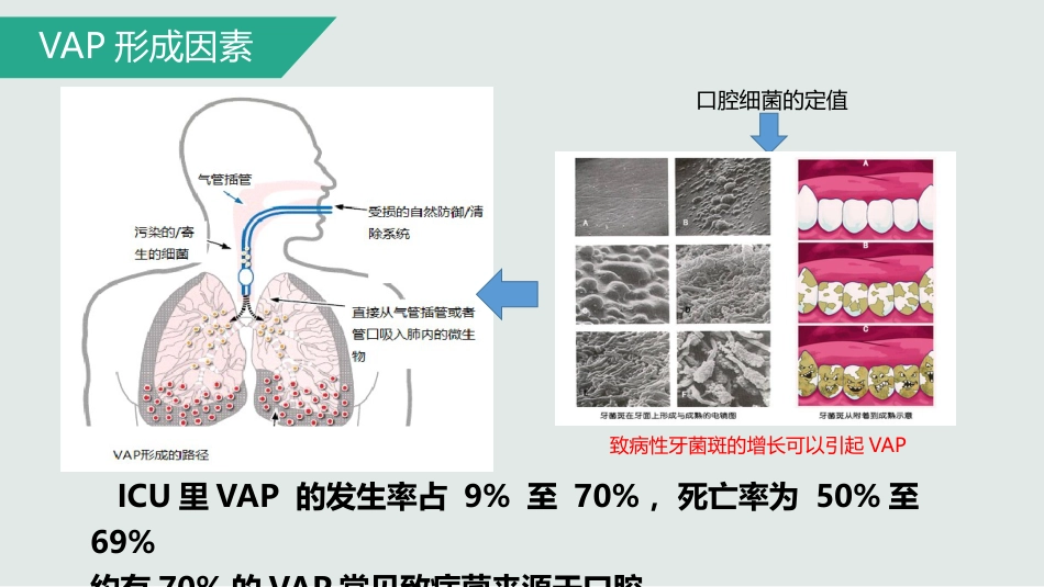 ICU患者口腔护理新技术_第7页