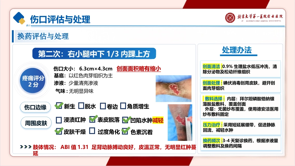 一例下肢静脉溃疡的护理pptx_第10页