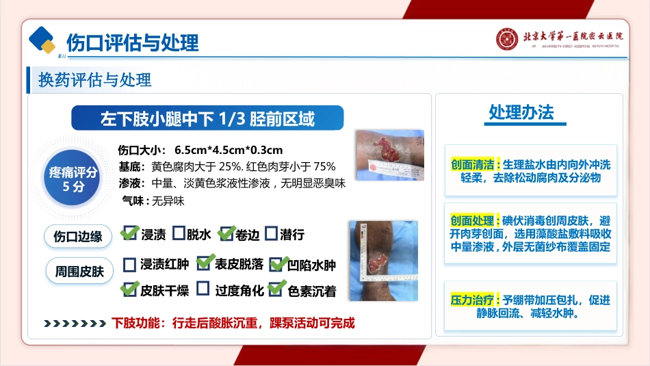 一例下肢静脉溃疡的护理pptx_第8页