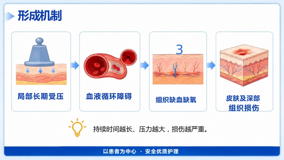 （压疮）压力性损伤的预防及护理_第5页