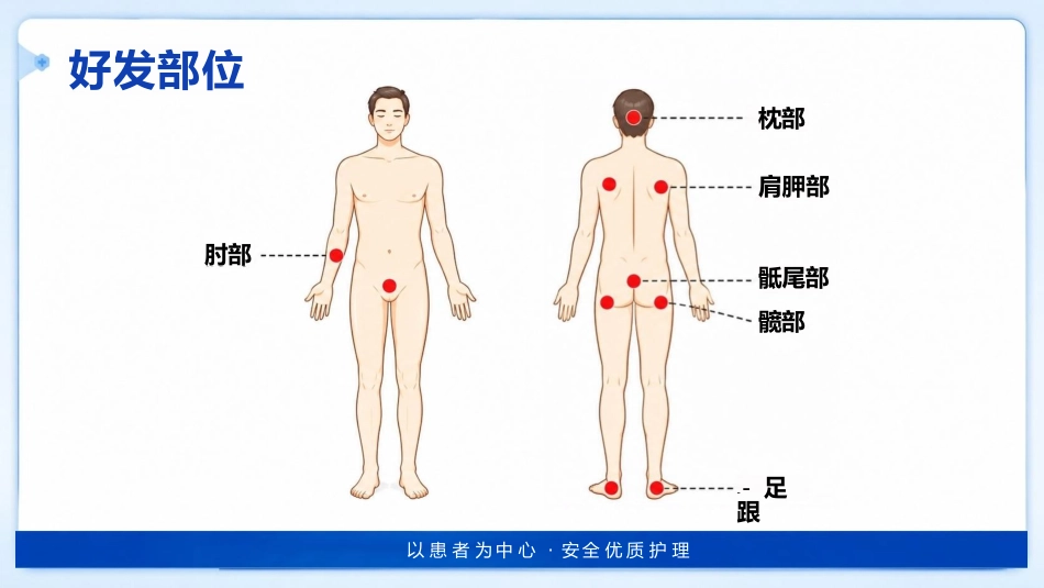 （压疮）压力性损伤的预防及护理_第7页