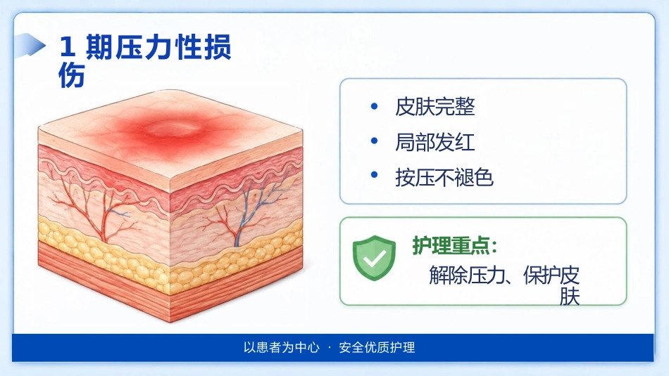 （压疮）压力性损伤的预防及护理_第9页