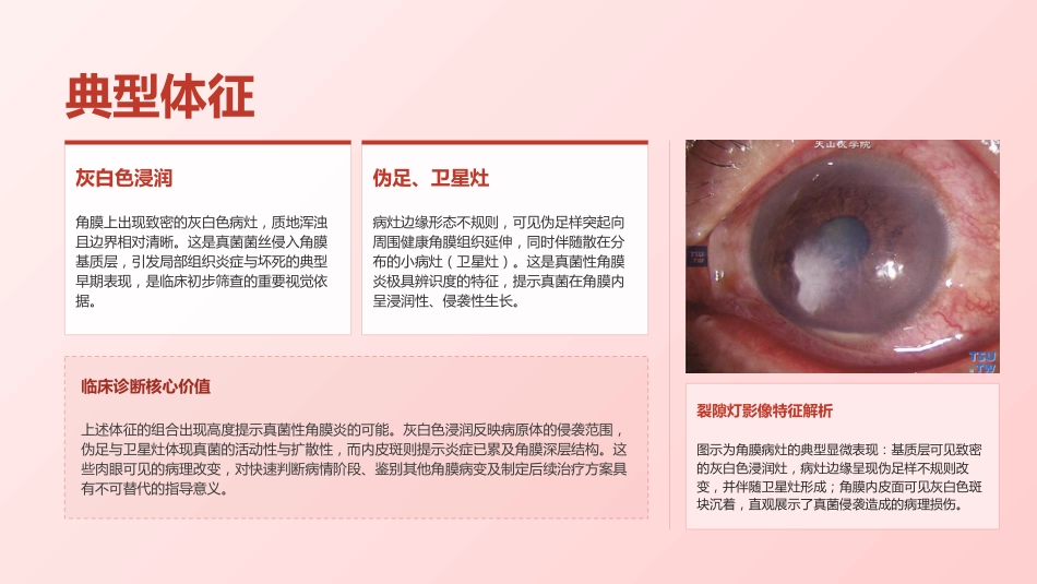真菌性角膜病规范化护理与临床实践(7)_第11页