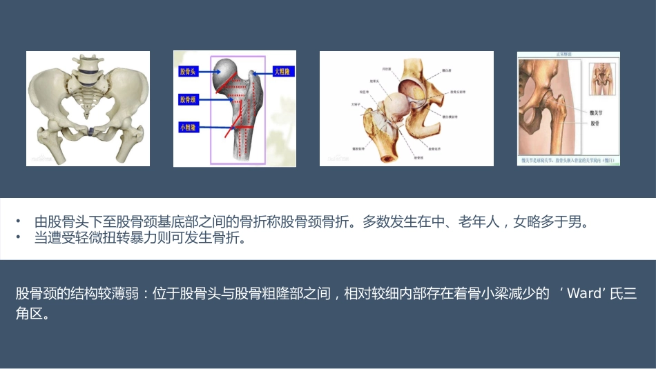 髋关节置换术后护理（21页）_第3页