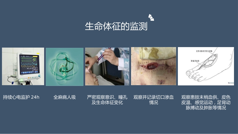 髋关节置换术后护理（21页）_第6页