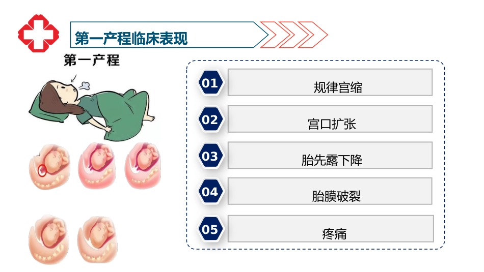 一例顺产患者护理查房-1_第7页