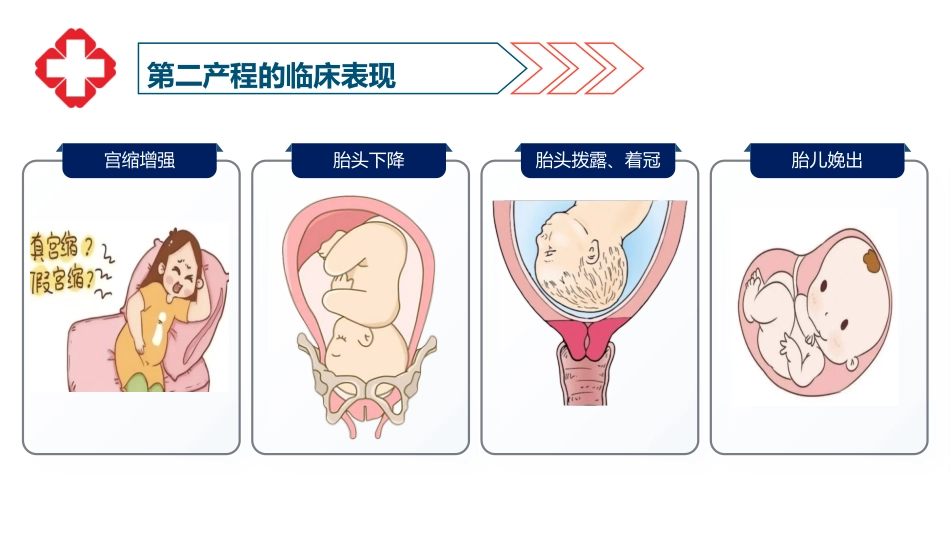 一例顺产患者护理查房-1_第8页