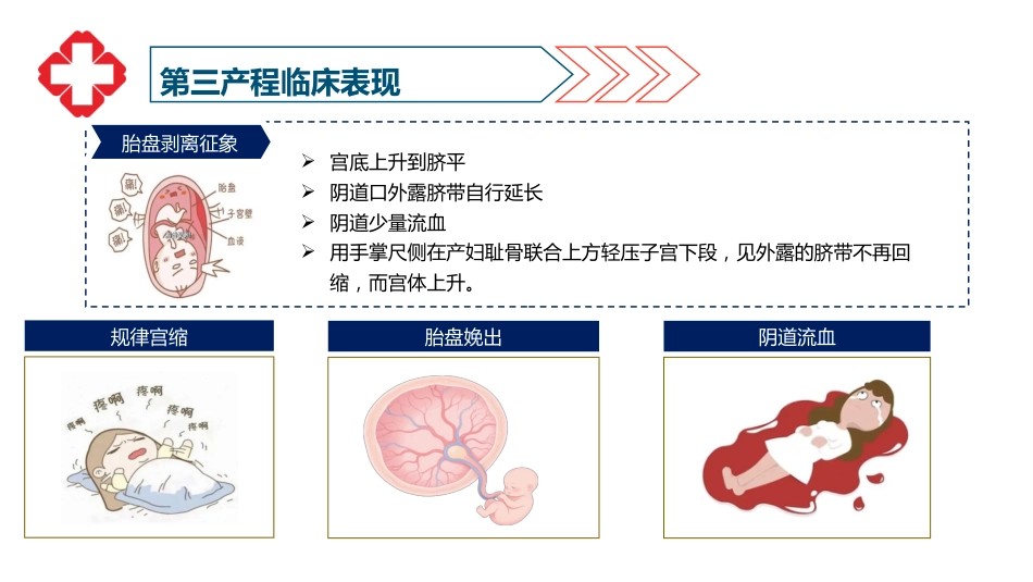 一例顺产患者护理查房-1_第9页