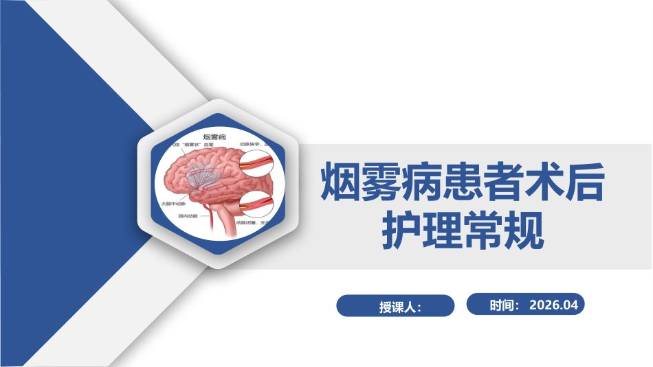 烟雾病患者术后护理常规（27页）_第1页