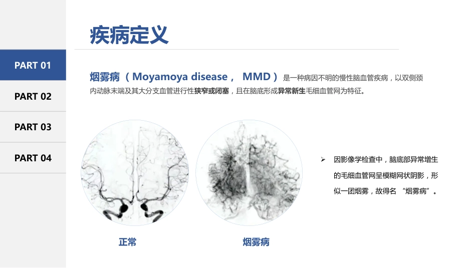 烟雾病患者术后护理常规（27页）_第4页