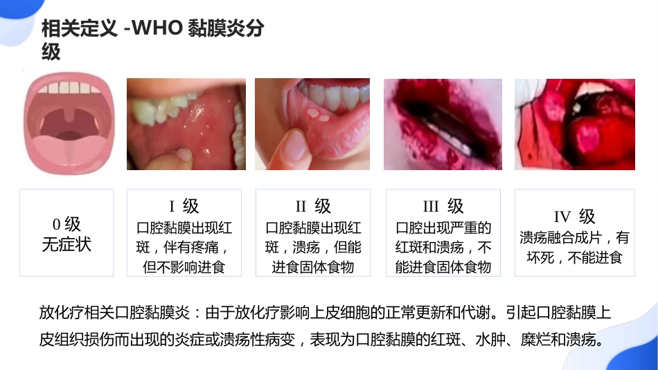 不同类型口腔黏膜炎护理_第9页