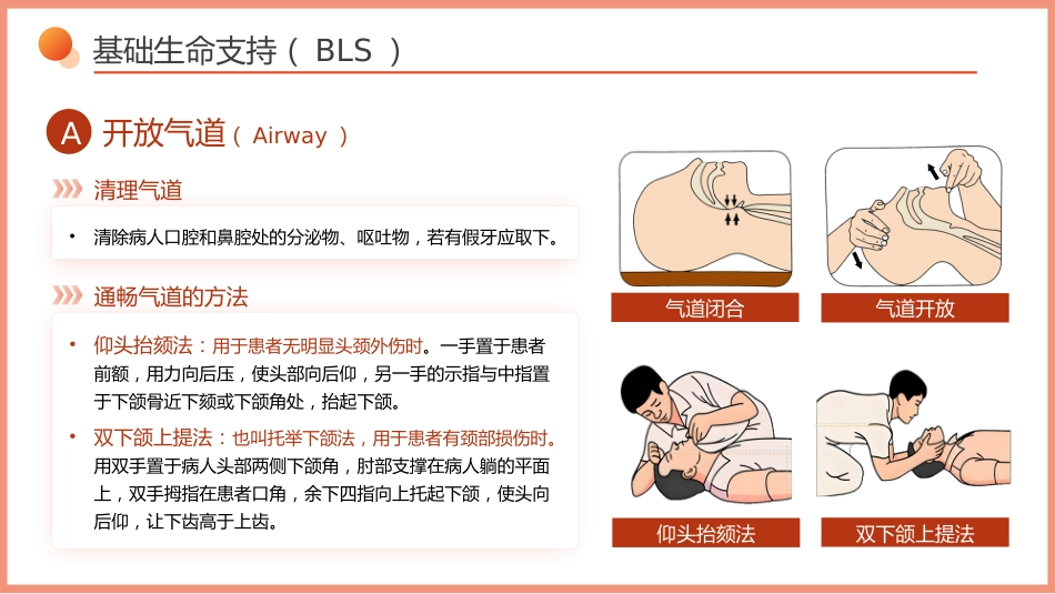 心脏骤停的急救与护理-1_第14页