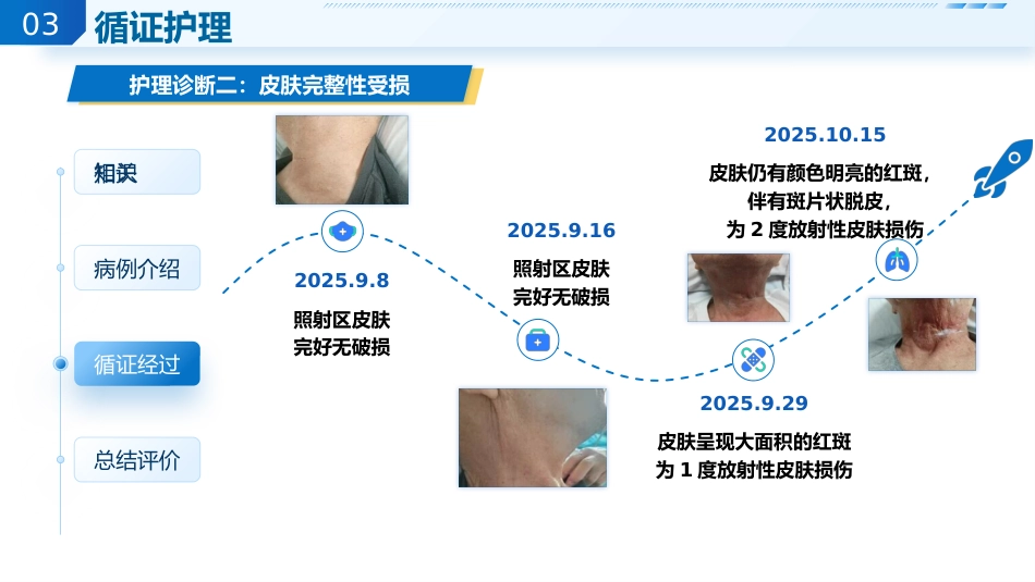 1例喉恶性肿瘤患者的循证护理查房_第14页