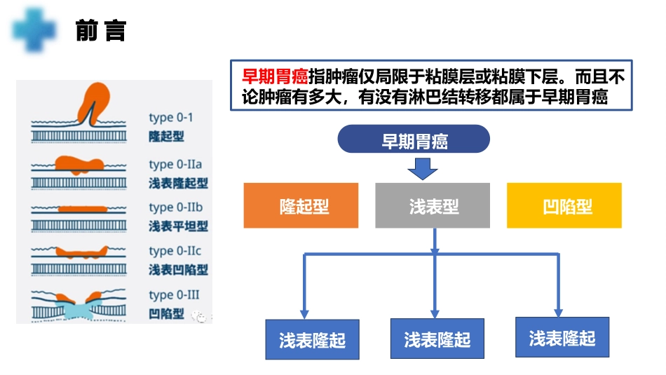 1例胃癌术后并发肠梗阻患者的疑难病例讨论_第3页