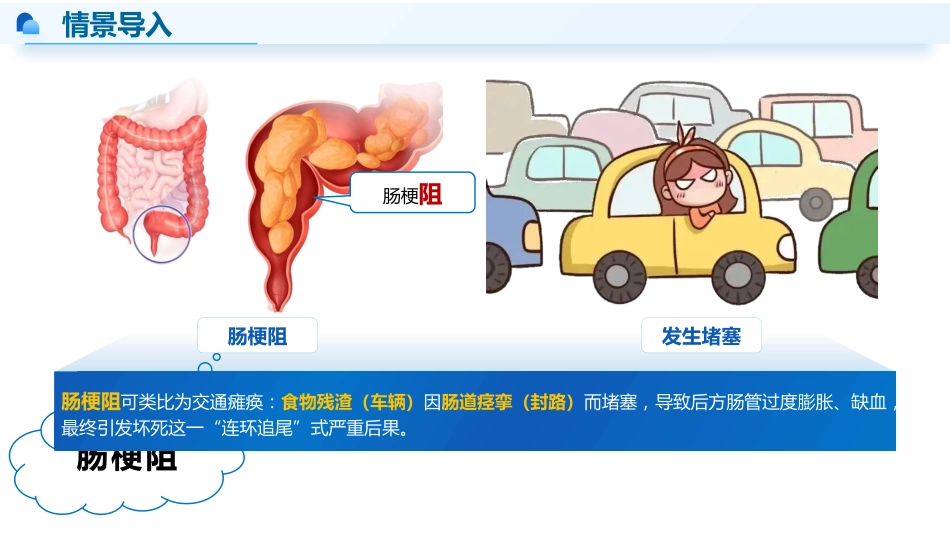 肠梗阻患者的早期-3_第4页