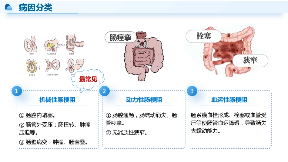 肠梗阻患者的早期-3_第7页