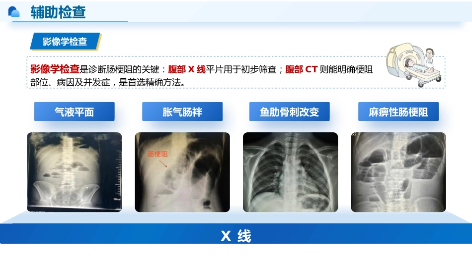 肠梗阻患者的早期-3_第9页