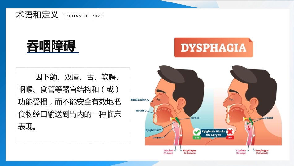 成人吞咽障碍患者口服给药护理（2025团标）_第10页