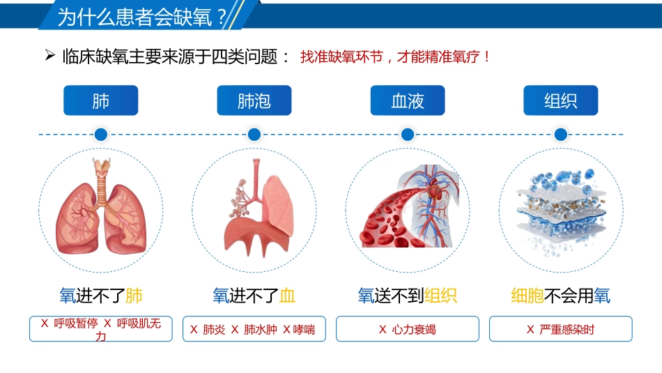 氧疗技术的规范护理_第5页
