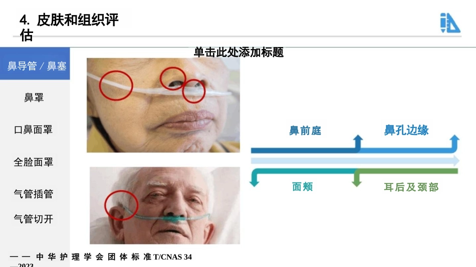 成人呼吸支持治疗器械相关压力性损伤的预防-29页_第13页