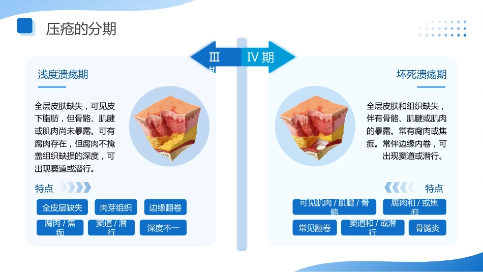 压疮的预防与护理讲座-1_第15页