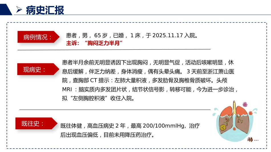 胸腔积液患者护理查房_第14页