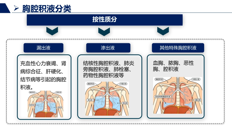 胸腔积液患者护理查房_第8页
