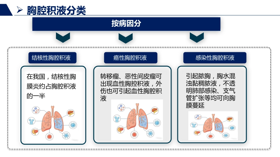 胸腔积液患者护理查房_第9页