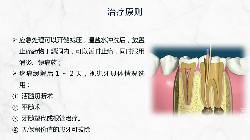 牙髓炎的护理查房知识课件_第14页