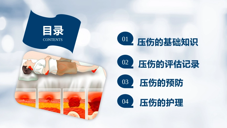 压伤的预防与护理PPT-2_第2页