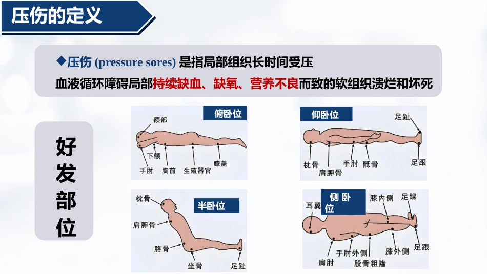 压伤的预防与护理PPT-2_第4页