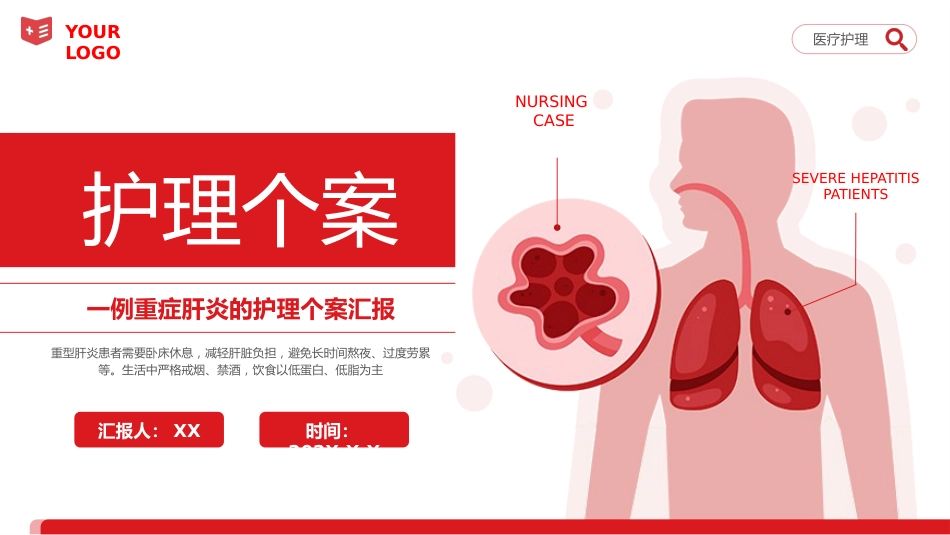 重症肝炎护理个案医疗健康护理培训PPT_第1页