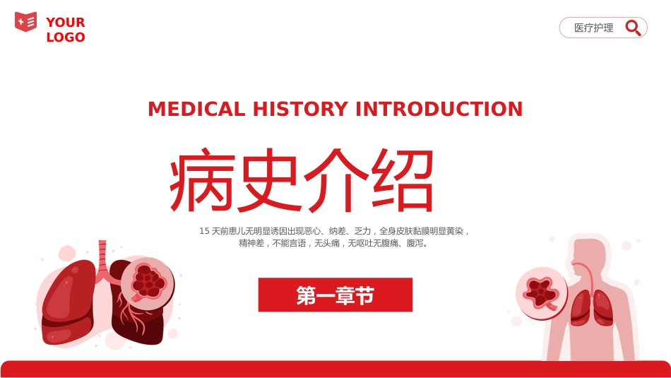 重症肝炎护理个案医疗健康护理培训PPT_第3页