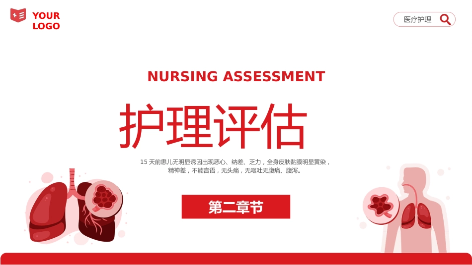 重症肝炎护理个案医疗健康护理培训PPT_第7页