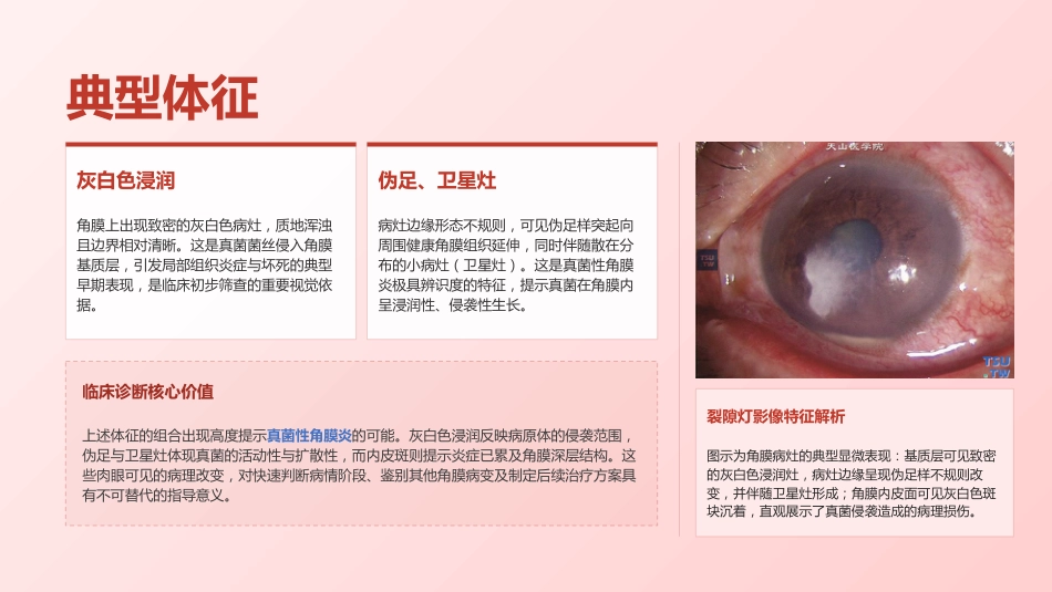 定制-真菌性角膜病规范化护理与临床实践(7)_第11页