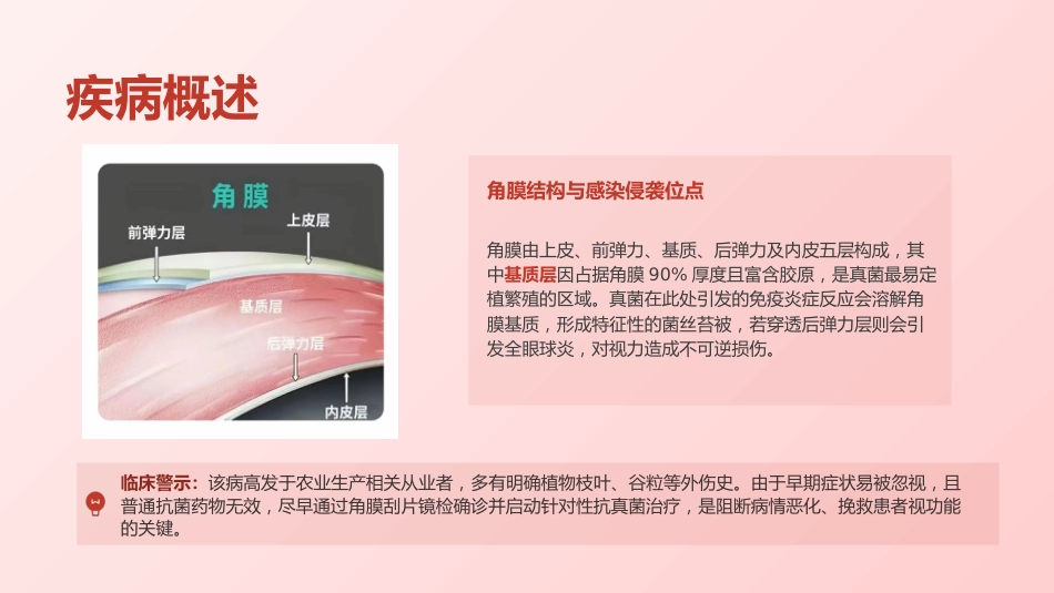 定制-真菌性角膜病规范化护理与临床实践(7)_第4页