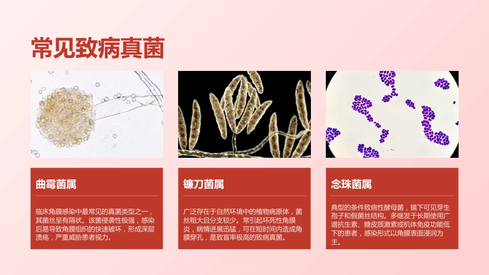 定制-真菌性角膜病规范化护理与临床实践(7)_第7页