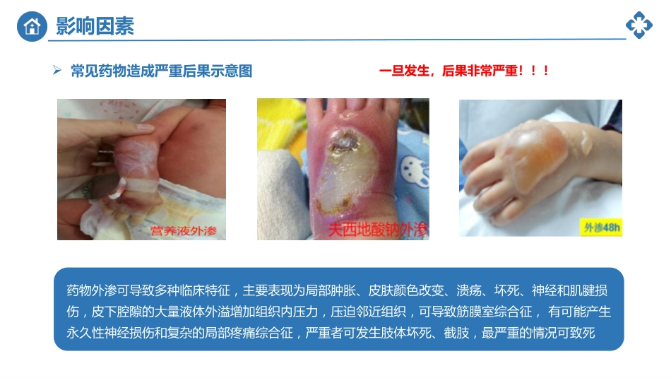 小儿静脉输液外渗的预防及处理_第11页