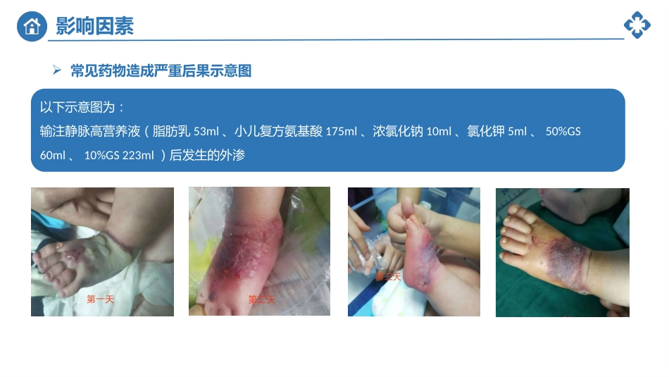 小儿静脉输液外渗的预防及处理_第12页