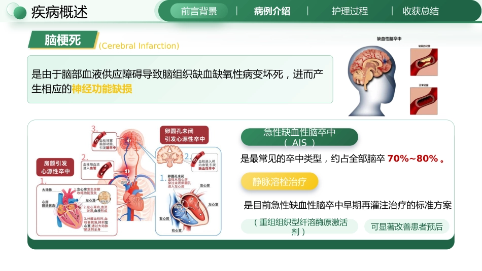 一例静脉溶栓患者康复护理个案_第3页
