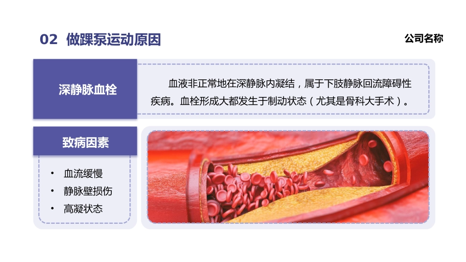 踝泵运动培训_第8页