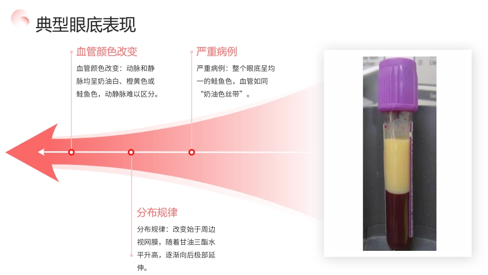 视网膜脂血症护理查房带参考文献_第12页