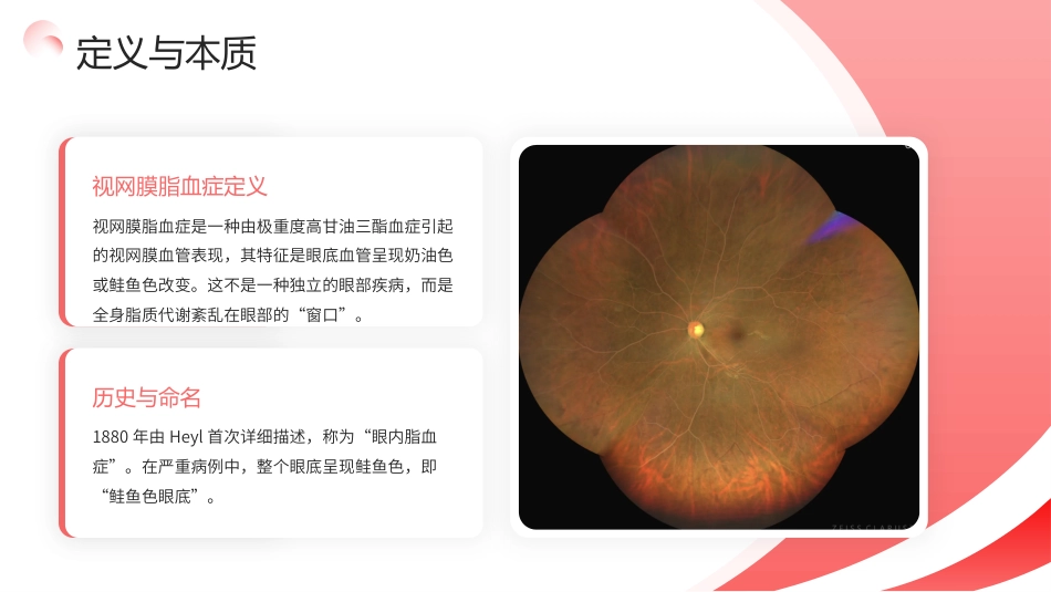视网膜脂血症护理查房带参考文献_第4页